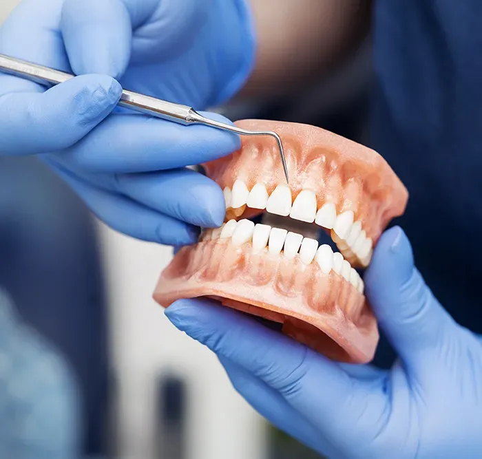 https://implantacija.lt/wp-content/uploads/2025/04/Dantu-implantacijos-etapai-5-2.webp