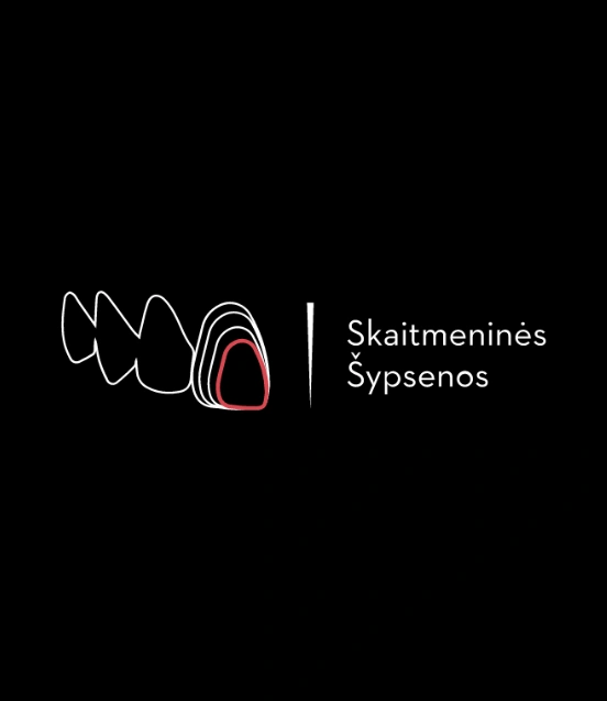Dantų implantacija